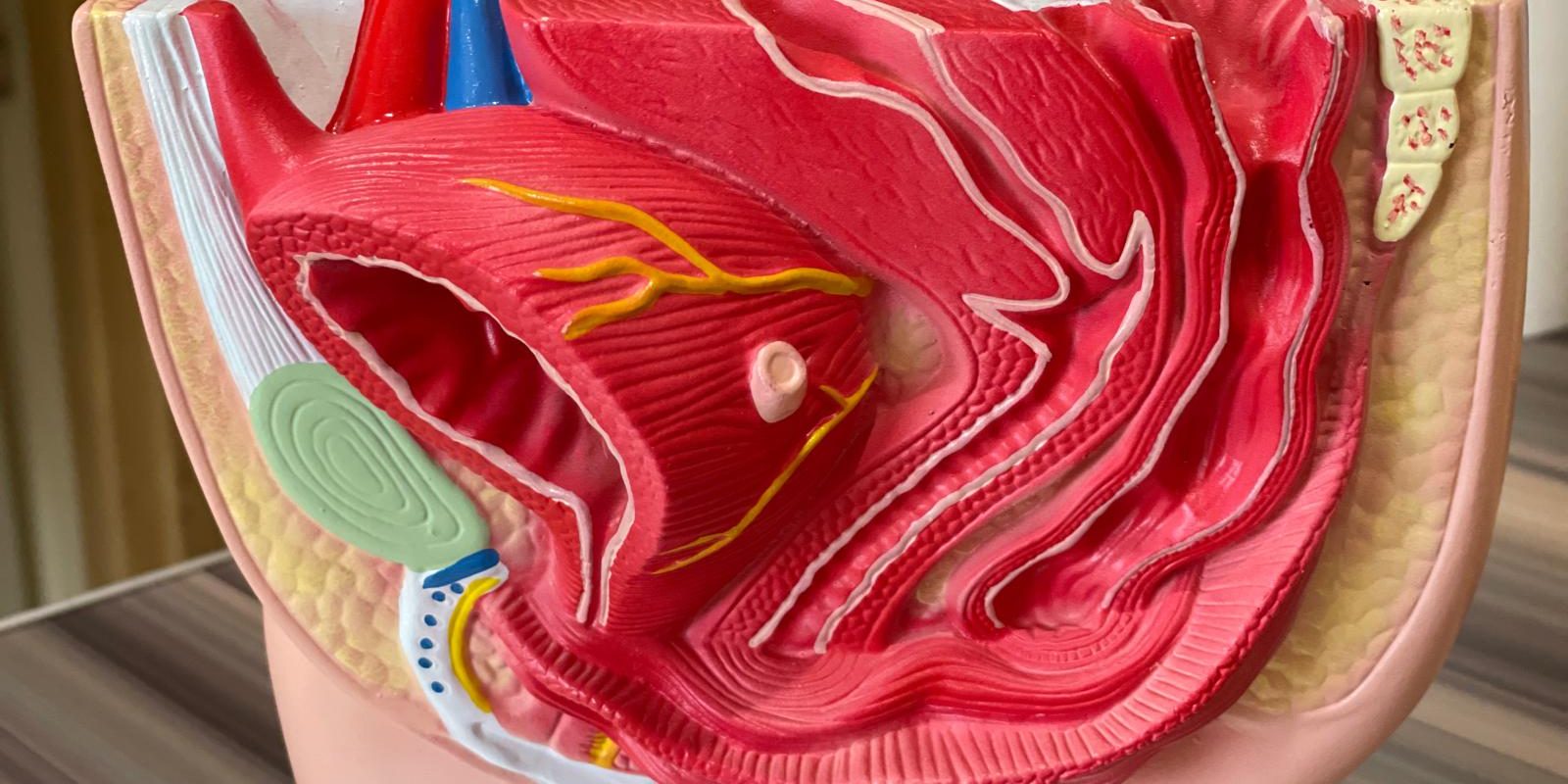 Prolapsul Uterin