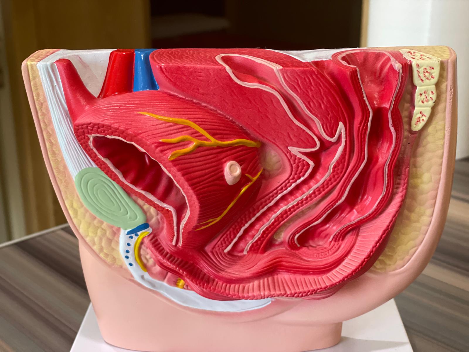 Prolapsul Uterin