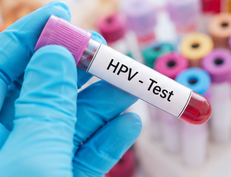 Test HPV